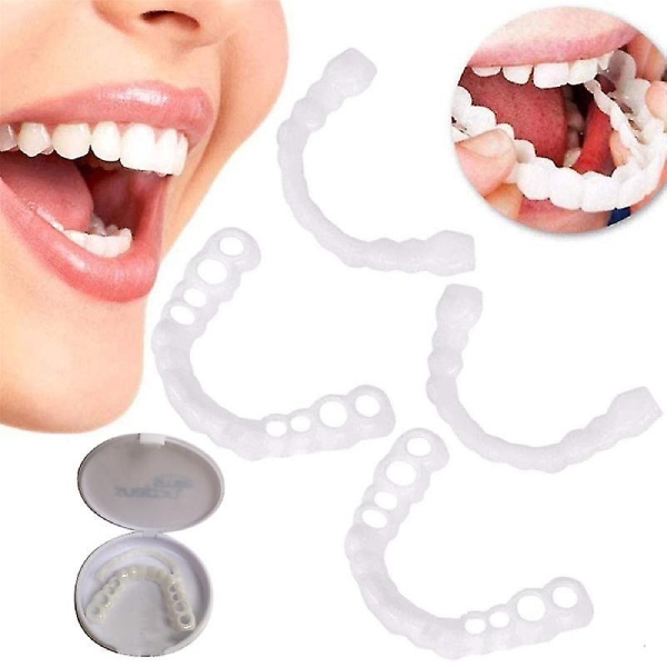 SmileSet Teeth Braces Review