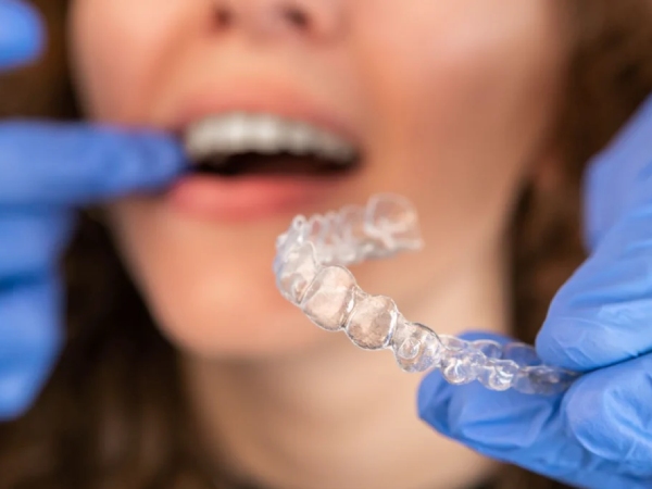 SmileSet Night Guards Review